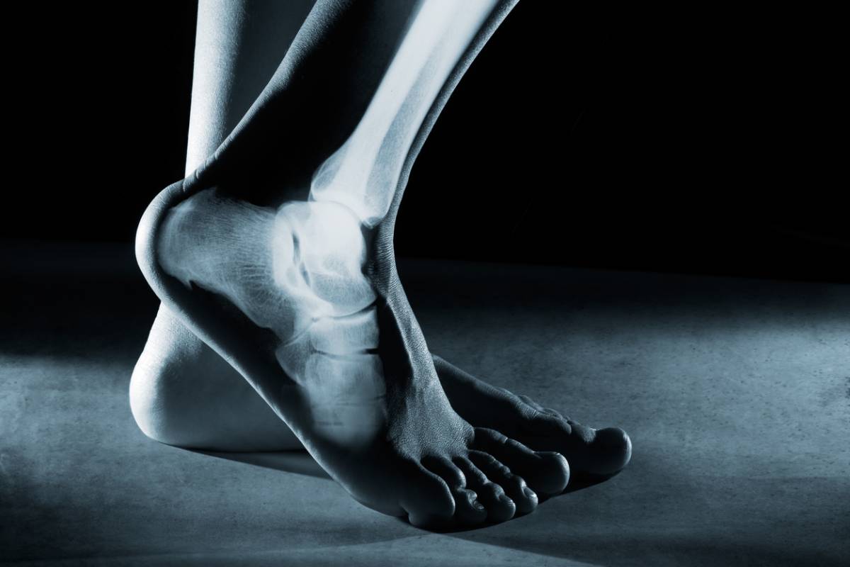 Image of foot x-ray