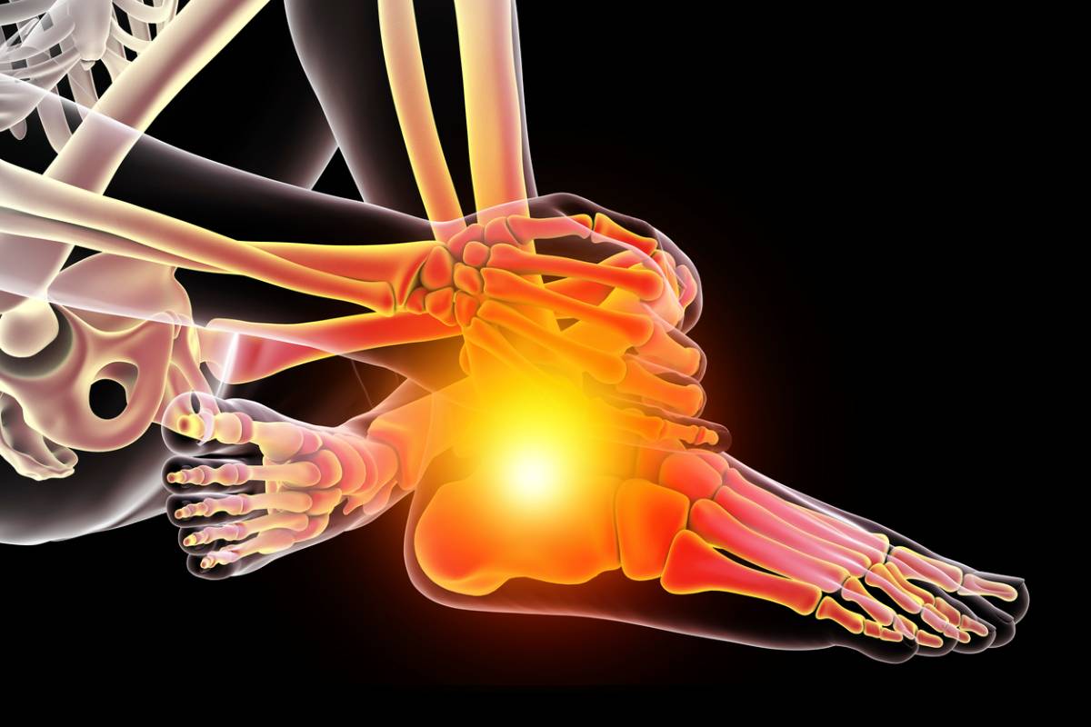 Signs of a Cracked Heel Bone